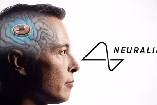 Neuralink cấy ghép chip não thành công cho bệnh nhân đầu tiên