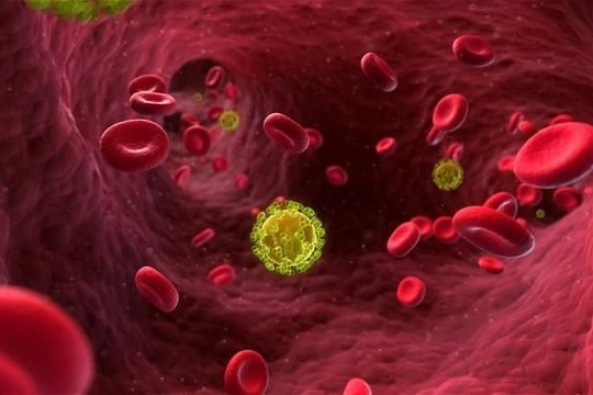 Virus HIV trong máu bệnh nhân.