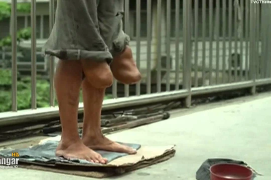 Người ăn xin cụt chân lộ nguyên hình