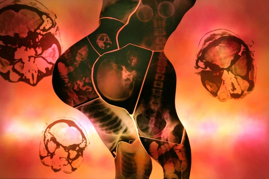 Mỹ nhân - X quang trên hộp đèn - Tác phẩm của họa sĩ Doãn Hoàng Lâm. 