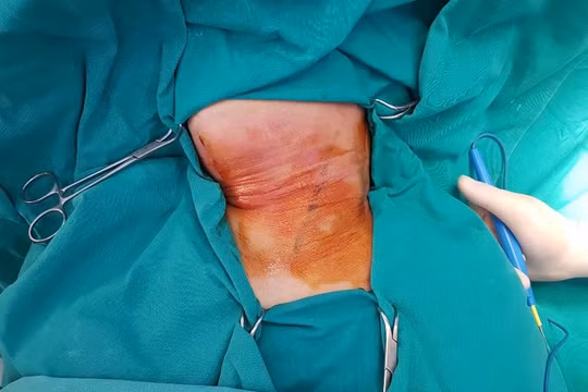 Hình ảnh tổn thương của bệnh nhân. Ảnh: Bệnh viện cung cấp 