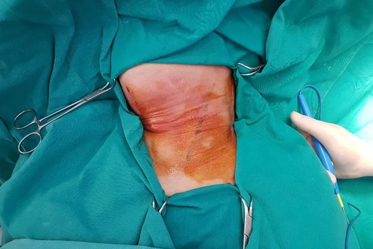 Hình ảnh tổn thương của bệnh nhân. Ảnh: Bệnh viện cung cấp 