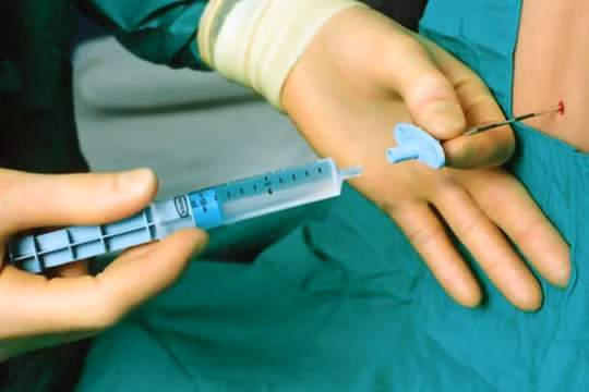 Gây tê tủy sống