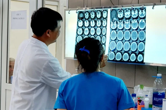 Hình ảnh phim chụp não bệnh nhân bị xuất huyết do ngộ độc ma túy đá