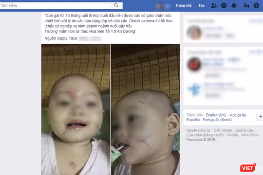 Hình ảnh của bé L.Đ. trên mạng xã hội 