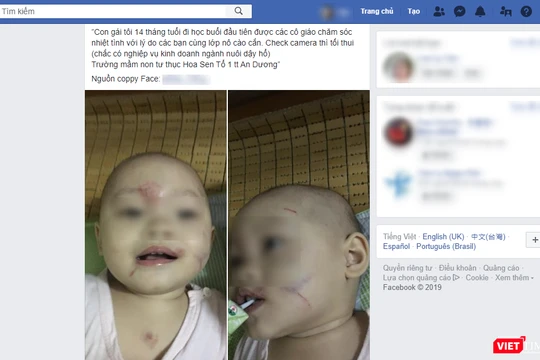 Hình ảnh của bé L.Đ. trên mạng xã hội 