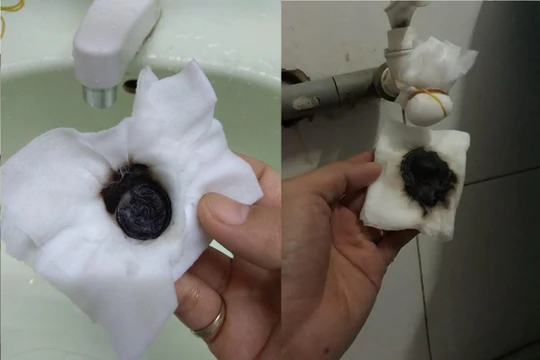 Dư luận và người dân Đà Nẵng mấy ngày nay lo lắng về chất lượng nước sinh hoạt khi chứng kiến cặn bẩn và vị lợ. (Ảnh: Nguyệt Cát)