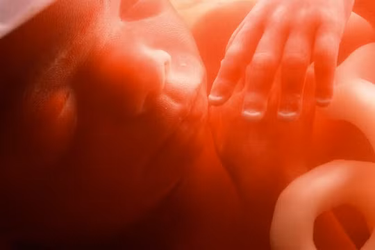 Ảnh minh họa: CNET