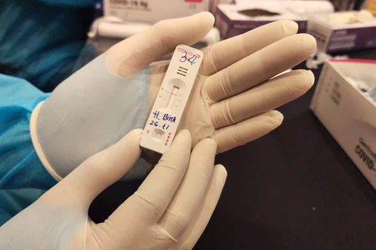 Test nhanh kháng nguyên COVID-19. Ảnh: Hoà Bình