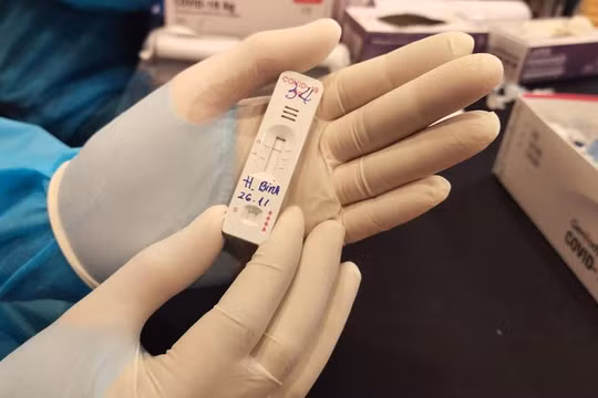 Test nhanh kháng nguyên COVID-19. Ảnh: Hoà Bình