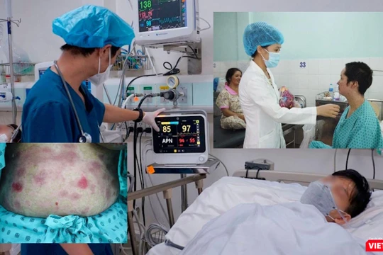 Bệnh nhân cấp cứu vì lạm dụng thực phẩm chức năng. Ảnh: MT