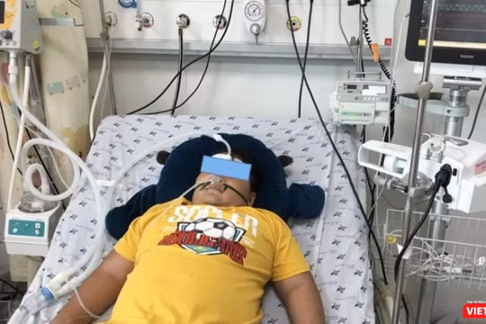 Một bệnh nhi bị hội chứng viêm đa hệ thống sau mắc Covid-19 (Ảnh- BV Nhi đồng Thành phố)