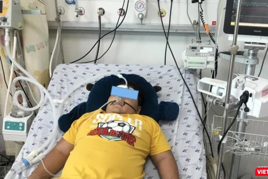 Một bệnh nhi bị hội chứng viêm đa hệ thống sau mắc Covid-19 (Ảnh- BV Nhi đồng Thành phố)