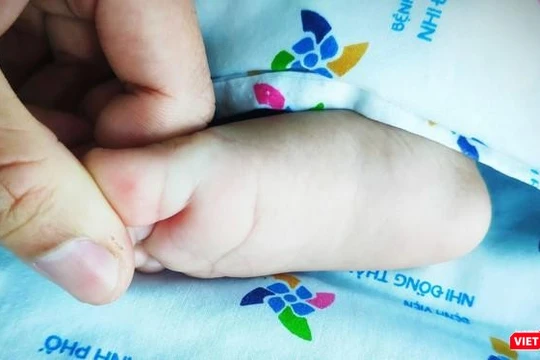 Tay chân miệng có thể gây nhiều biến chứng nguy hiểm ở trẻ. Ảnh: Bệnh viện Nhi Đồng TP.HCM