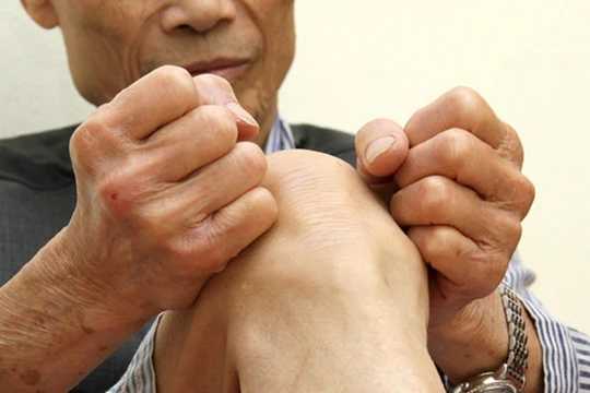 Nếu không được điều trị hiệu quả và kịp thời, bệnh đau đầu gối ở người già có thể dẫn đến những biến chứng khó lường.