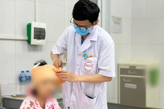 Bé gái 5 tuổi bị chó cắn 10 vết ở đầu, mặt