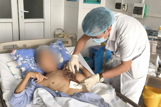 Người quản trang suýt chết vì một loại nấm đen hiếm gặp