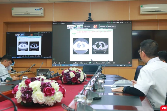 Bệnh viện Việt Đức hội chẩn khẩn cấp từ xa hỗ trợ cấp cứu nạn nhân vụ tai nạn ở Sơn La