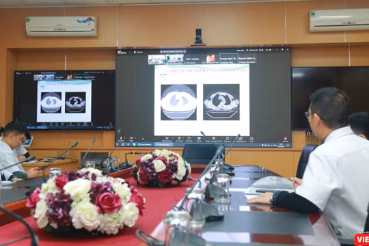 Bệnh viện Việt Đức hội chẩn khẩn cấp từ xa hỗ trợ cấp cứu nạn nhân vụ tai nạn ở Sơn La