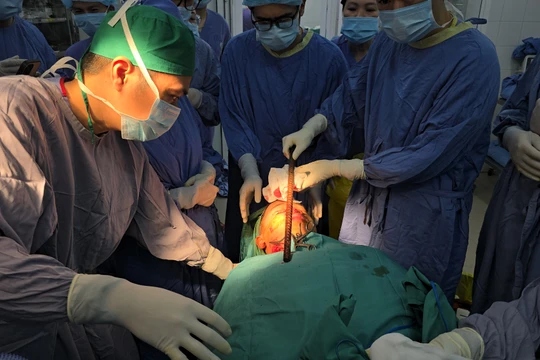 Giành lại sự sống cho nam sinh bị thanh sắt xuyên qua mặt