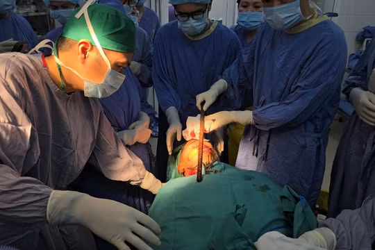 Giành lại sự sống cho nam sinh bị thanh sắt xuyên qua mặt