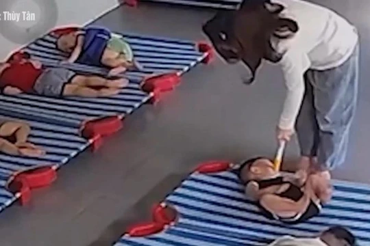 Bộ Y tế vào cuộc vụ bé 20 tháng tuổi bị bảo mẫu xách ngược đánh tới tấp