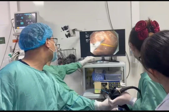 Chiếc tăm 7cm cắm sâu trong dạ dày, bệnh nhân thoát chết trong gang tấc 