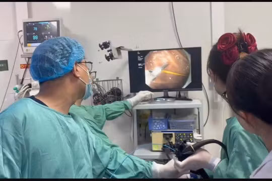 Chiếc tăm 7cm cắm sâu trong dạ dày, bệnh nhân thoát chết trong gang tấc 