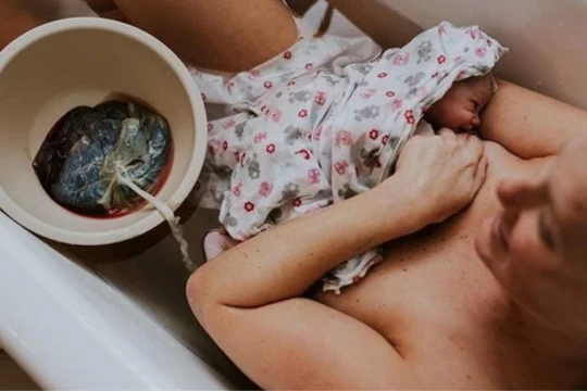 Nguy cơ tái diễn trào lưu sinh con thuận tự nhiên