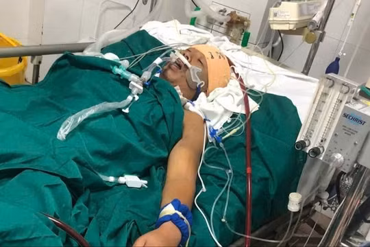 Dập nát ngực, phổi do rơi từ tầng 4, thợ xây vượt cửa tử sau 5 ngày đặt ECMO