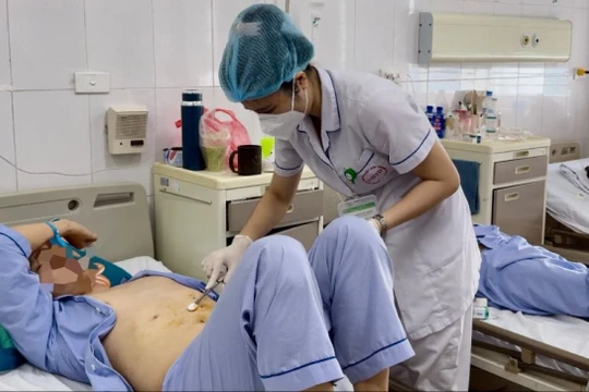 Hy hữu bệnh nhân bị xương cá dài 4cm chui vào gan gây áp xe