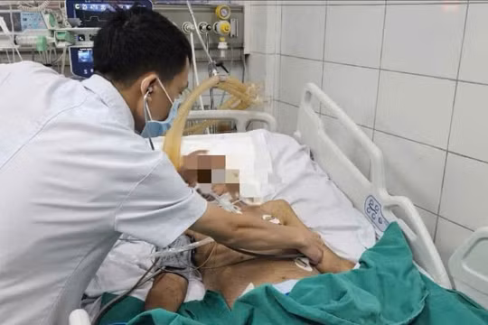 Nhiễm giun lươn, người đàn ông ở Hà Nội nguy kịch