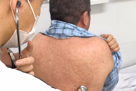 Sau ca người lớn tử vong do sởi, thêm nhiều trường hợp biến chứng nặng