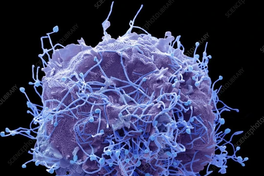 Bộ Y tế: Chưa xác định tác nhân gây "bệnh lạ” tại Nga