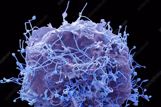 Bộ Y tế: Chưa xác định tác nhân gây "bệnh lạ” tại Nga