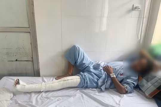 Điều tra vụ người phụ nữ tố cáo bị bảo vệ Bệnh viện K đánh gãy chân