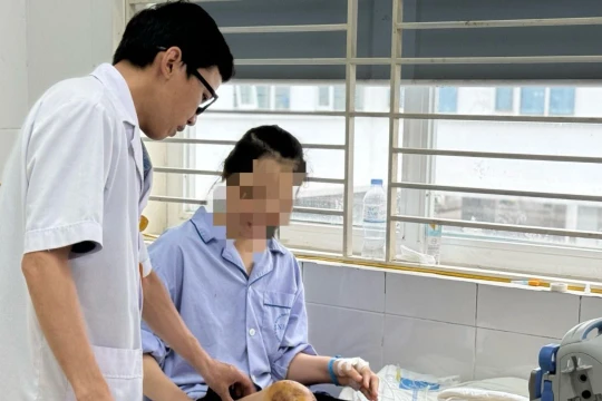 Cho ong đốt để chữa bệnh, người phụ nữ bị nhiễm độc, mê sảng