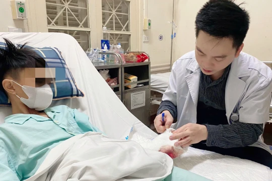 Liên tiếp ba cháu bé bị tại nạn do chơi pháo tự chế