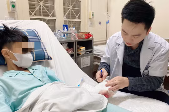 Liên tiếp ba cháu bé bị tại nạn do chơi pháo tự chế