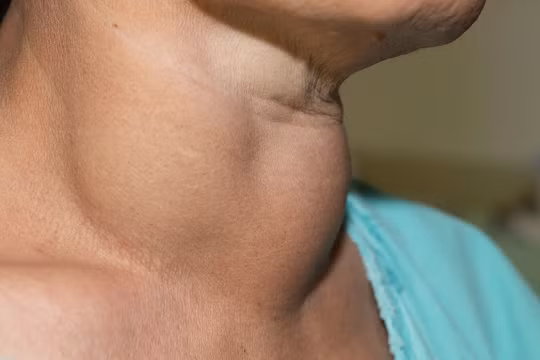 Doanh nghiệp phản đối bổ sung vi chất dinh dưỡng vào muối, bột mì: Các nhà khoa học nói gì? 