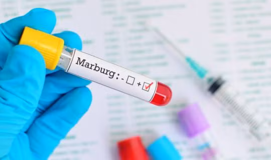 Virus Marburg khiến 9 người chết và WHO lập tức phải họp khẩn (ảnh: Bimbisaniebelli)