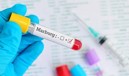 Virus Marburg khiến 9 người chết và WHO lập tức phải họp khẩn (ảnh: Bimbisaniebelli)