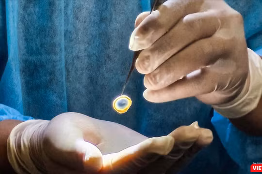 Cụ ông để lại di nguyện được hiến mô, tạng khi qua đời.