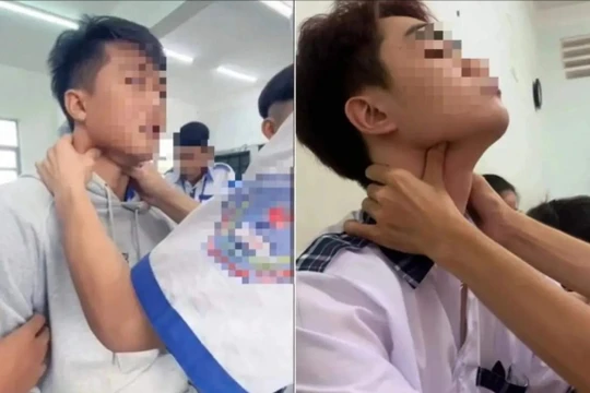 Bác sĩ cảnh báo: Trò “bắt pen” ở giới trẻ cực nguy hiểm, có thể gây tử vong