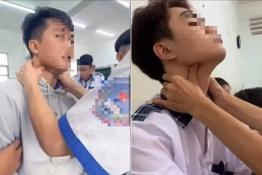 Bác sĩ cảnh báo: Trò “bắt pen” ở giới trẻ cực nguy hiểm, có thể gây tử vong