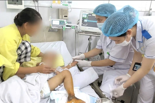 Bé 4 tuổi suy gan thận, hoại tử chân vì gia đình đắp thuốc nam chữa mèo cắn