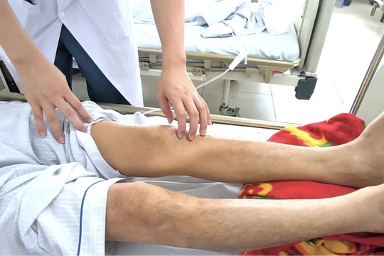 Giun chó mèo “ăn” vào não vì nuôi thú cưng bẩn, ăn uống nguy hiểm