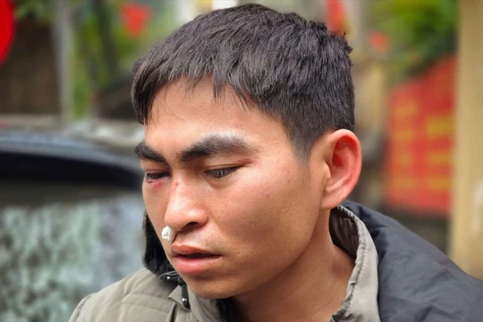 Diễn biến mới vụ nam shipper bị tài xế xe Lexus hành hung đến chấn động não