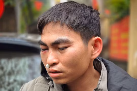 Diễn biến mới vụ nam shipper bị tài xế xe Lexus hành hung đến chấn động não