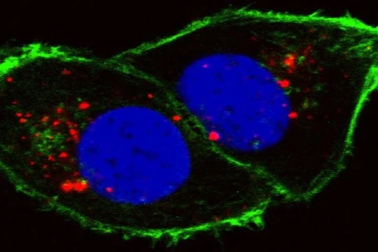Tế bào ung thư thận (Ảnh Viện nghiên cứu ung thư quốc gia/Đại học Stanford)